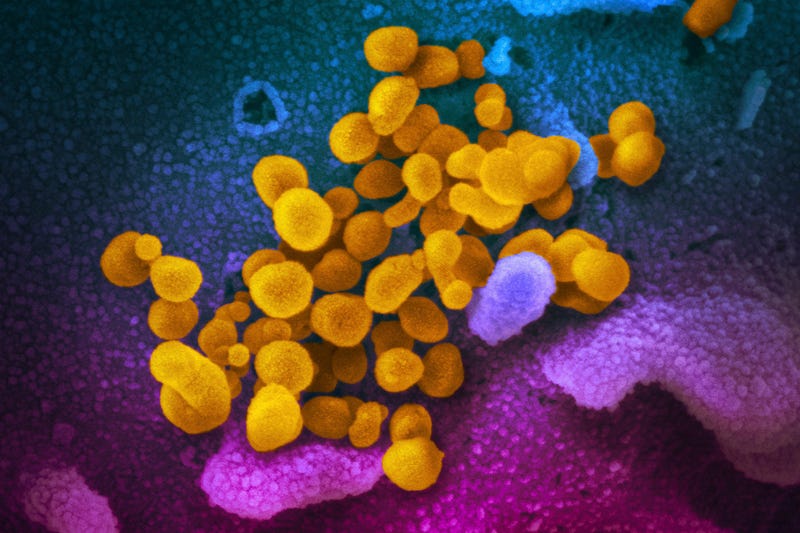 ویروس کرونا (زرد رنگ) در حال خروج از سلول‌ها